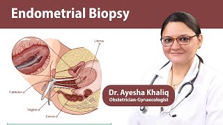 What is Endometrial Uterine Biopsy  Tests for Endometrial Cancer  Dr Ayesha Khaliq [upl. by Anairuy544]