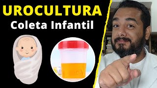 Urocultura em crianças e bebês como fazer a coleta de urina  cultura de urina [upl. by Editha]