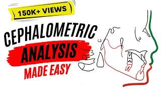 Cephalometric analysis [upl. by Vasos]