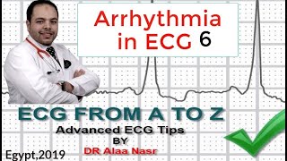 ECG from A to Z intermediate level Arrhythmia 6 Dr Alaa Nasr 2019 [upl. by Noreen12]