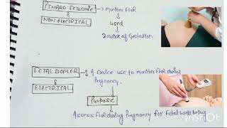 Pinard Fetoscope  Fetal Dopler  Norcet  Image  Based  Mcq [upl. by Colbert]