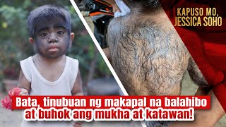 Bata tinubuan ng makapal na balahibo at buhok ang mukha at katawan  Kapuso Mo Jessica Soho [upl. by Aynwad428]