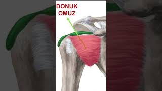 FizyoCare  Donuk Omuz Sendromu Tedavisi [upl. by Rehsu]