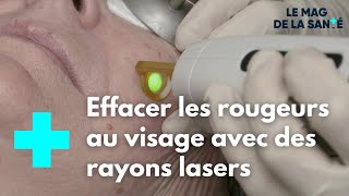 Couperose  sen débarrasser grâce au laser vasculaire  Le Magazine de la Santé [upl. by Reiche]