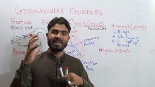 Cardio Vascular Disorders Thrombus Embolus Atherosclerosis Heart Attack Angina Pectoris and Stroke [upl. by Akceber]