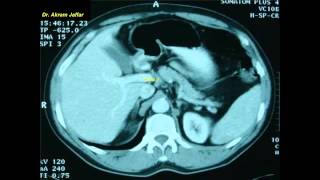 Cross sectional and imaging anatomy of the abdomen [upl. by Jeno185]