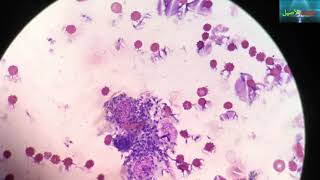 leishmania under the microscope  leishmaniose  الليشمانيا [upl. by Cannice450]