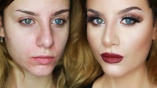 Base VISO Pelle PERFETTA come Photoshop Coprire OCCHIAIEBRUFOLIROSSORI  Make up Tutorial [upl. by Krista696]