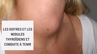 Les goitres et les nodules thyroïdiens et conduite à tenir [upl. by Bealle872]