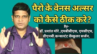 Foot Ulcer Treatment at home in Hindi Varicose Ulcer Treatment  Ulcer Treatment in Hindi [upl. by Harriett]