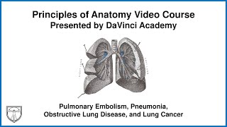 Pulmonary Embolism Pneumonia Obstructive Lung Disease and Lung Cancer Thorax Anatomy 7 of 16 [upl. by Laeahcim]