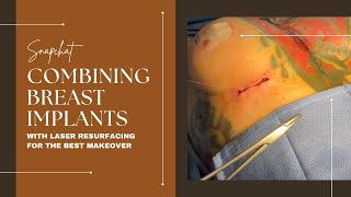 SNAPCHAT  COMBINING BREAST IMPLANTS WITH LASER RESURFACING FOR THE BEST MAKEOVER  Dr Emer amp Rojas [upl. by Ynohtnanhoj710]