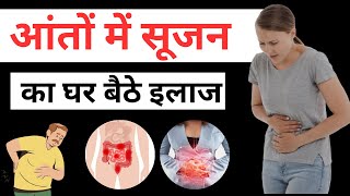 आंतो में सूजन Crohns disease  Causes Symptoms Diagnosis and Treatment crohnsdisease [upl. by Adnahc]