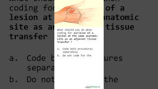 2024 CPT GUIDELINES  ROTATIONAL FLAP [upl. by Caryl]