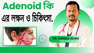 শিশুর এডিনয়েড বড় হলে কি কি সমস্যা হয়  এডেনয়েড কি এবং এর লক্ষণ ও চিকিৎসা  DrSofiqul Islam [upl. by Yenffit962]