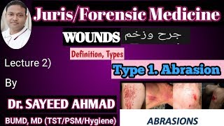 Jurisforensic medicinewoundsdefinitiontypesAbrasionMLC importance 3rd profLec2 [upl. by Easter]