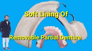 How to make soft liner Removable partial dentur  Soft Liner RPD by Haider [upl. by Othilia]