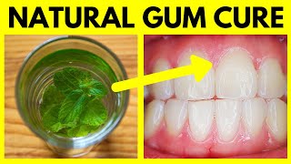 Best Mouthwash for Gum Disease – Cure Periodontal Disease amp Gingivitis Natural Home Remedy Treatment [upl. by Zoi]