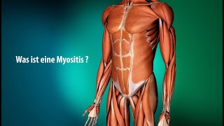 Erklärvideo Myositis [upl. by Appleton879]