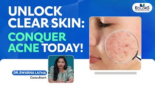 Understanding Acne Causes Types and Treatments for Clear Skin [upl. by Rafaello532]