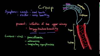 What is croup [upl. by Johnathon521]