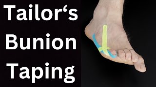 Tailors Bunion Pain Relief Taping [upl. by Nyrtak318]