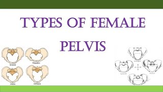 Types of Female Pelvis [upl. by Geof]