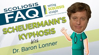 Scoliosis FAQ  Scheuermanns Kyphosis [upl. by Aigil]