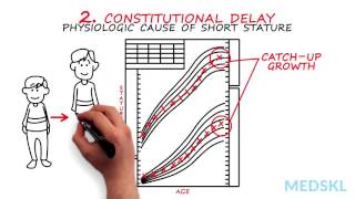 Pediatrics – Stature Abnormalities By Kyle McNerney MD [upl. by Idna451]