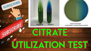 Citrate utilization test।। Microbiology in hindi [upl. by Sacksen453]