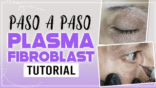 PLASMA PEN FIBROBLAST paso a paso  párpado caído  ojos  PLASMA PEN  plasmapen CarolinaTV [upl. by Asiralc]