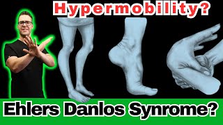 Ehlers Danlos Syndrome Hypermobility Symptoms Diagnosis amp Test [upl. by Eli]