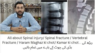 Spinal injury Spinal fracture  Vertebral Fracture  Haram Maghaz ki chot Kamar ki chot ka ilaaj [upl. by Volnay]