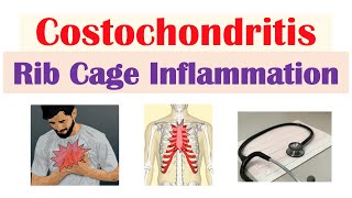 Costochondritis Rib Cage Inflammation  Causes Symptoms Diagnosis Treatment [upl. by Ennayt]