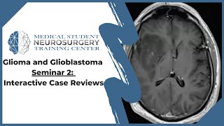 Glioma and Glioblastoma Seminar 2 Interactive Case Reviews [upl. by Krasner]