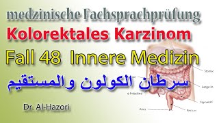 Kolonkarzinom Kolorektales Karzinom Innere Medizin medizinische Fachsprachprüfung سرطان المستقيم [upl. by Lorilyn861]