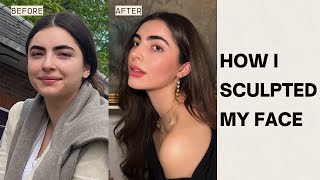 face transformation without surgery my journey controlling pcos amp cortisol [upl. by Llerrac]