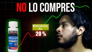 MAS  DE MINOXIDIL MAS BARBA NO LO COMPRES SIN VER ESTE VIDEO [upl. by Nylirac]