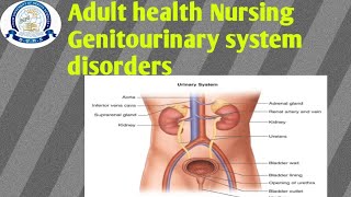 Genitourinary system Disorders  Adult health Nursing  3rd semester lacture by Sadaf ikram [upl. by Aneloj471]