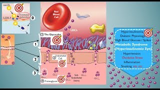 The Cholesterol Conundrum Part 2 Putting LDL Particle Count into Context [upl. by Bivins517]