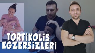 Sol Tortikolisli Bebek Esnemeler  Bebekler için Tortikolis Ev Egzersizleri👶 [upl. by Neeloc]