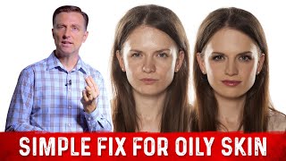 How To Fix Oily Skin With Simple Hack – Dr Berg [upl. by Given819]