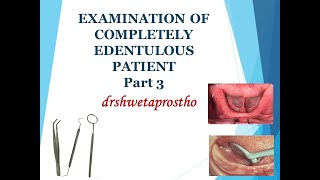 EXAMINATION OF COMPLETELY EDENTULOUS PATIENT PART 3 [upl. by Ikiv]