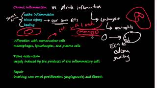 28  Chronic Inflammation  Introduction Macrophages [upl. by Dickman106]