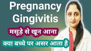 Pregnancy Gingivitis in Hindi मसूड़े से खून आनाकारण और उपचारbleedinggumsinpregnancypregnancycare [upl. by Bird]