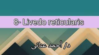 8 Livedo reticularis 👉 Dr Ahmed Anany [upl. by Harragan131]