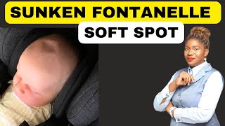 Causes and Treatment of a Sunken Fontanel and Soft Spot  Fontanelle [upl. by Kaylil]