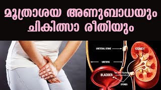 ഗ്ലൂട്ടാതയോണ് ഗുളിക🩺 Is This the Best Glutathione Supplement in India 🩺 Malayalam [upl. by Patrich]