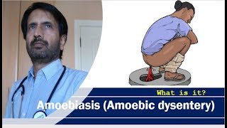 Amoebiasis Amoebic dysentery  Symptoms of dysentery [upl. by Justino]