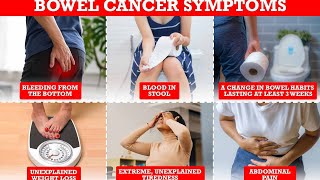 7 Warning Signs of Bowel Cancer A Deep Dive [upl. by Tegdig]